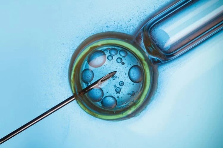 IVF — In Vitro Fertilization